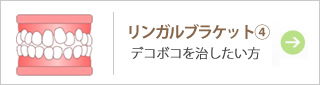 リンガルブラケット④