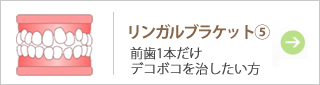 リンガルブラケット⑤