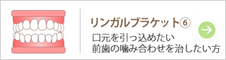 リンガルブラケット⑥