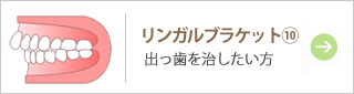 リンガルブラケット⑩