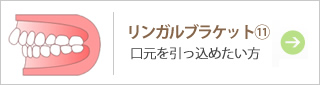 リンガルブラケット⑪