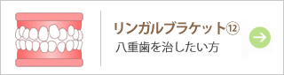リンガルブラケット⑫