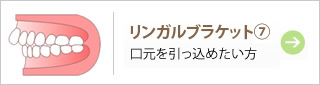 リンガルブラケット⑦