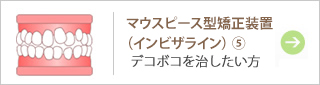 マウスピース型矯正装置（インビザライン）5
