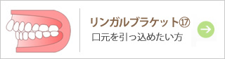 リンガルブラケット17