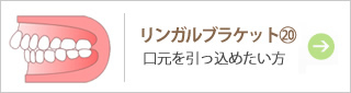 リンガルブラケット20