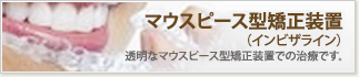 マウスピース型矯正装置（インビザライン）
