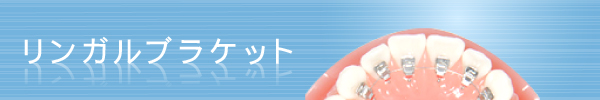 リンガルブラケット