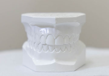 治療開始前に治療後の歯並びを再現します